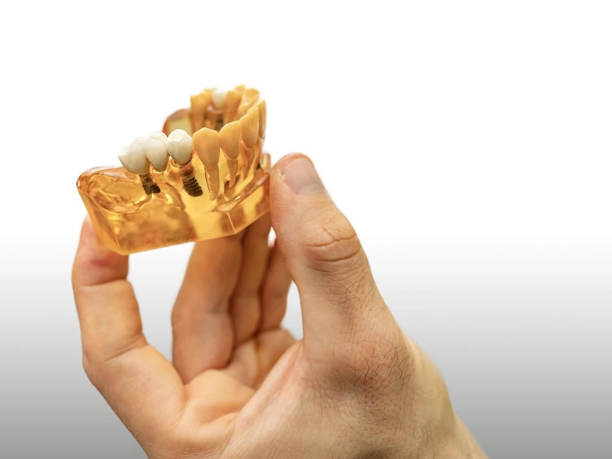 3D-gedrucktes Kiefermodell in der Hand